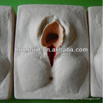 ISO 3 Set Model of Vulva Suturing Training Simulator